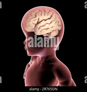 Un bambino con macrocefalia, ingrossamento del cervello, ipotonia, ritardo mentale e motorio dovuto a disturbi genetici, illustrazione del computer. Foto Stock