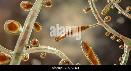 Fungo Trichophyton rubrum, illustrazione del calcolatore che mostra macroconidia, microconidia e iphae septate. Il T. rubrum è un dermatofita antropofilo. Foto Stock