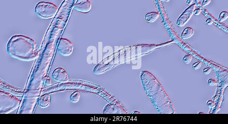 Fungo Trichophyton rubrum, illustrazione del calcolatore che mostra macroconidia, microconidia e iphae septate. Il T. rubrum è un dermatofita antropofilo. Foto Stock