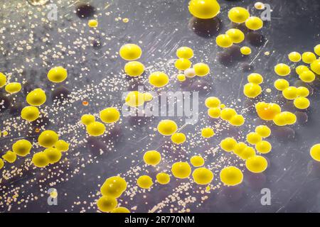 Batteri cresciuti da uno striscio cutaneo, colonie di Micrococcus luteus e Staphylococcus epidermidis su Tryptic Soy Agar. Foto Stock