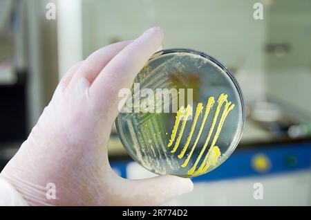 Colonie di batteri diversi e funghi muffati cresciuti su piastra di Petri con agar nutritivo, vista ravvicinata. Mano nella piastra di supporto del guanto bianca con nutriente m Foto Stock