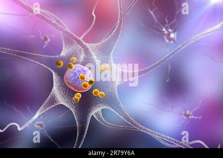 Il morbo di Parkinson. 3D illustrazione che mostra i neuroni contenenti i corpi di Lewy piccole sfere rosse che sono depositi di proteine accumulati nella cellula cerebrale Foto Stock