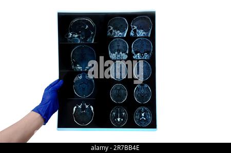 La mano nel guanto consente di eseguire scansioni cerebrali MRI o risultati di immagini di risonanza magnetica, concetto di neurologia, snapshot isolato su sfondo bianco Foto Stock