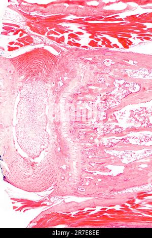 Tendine, pezzo di sinuo, sezione, micrografia a 20X luci. Colorato con ematossilina ed eosina, al microscopio. Foto Stock