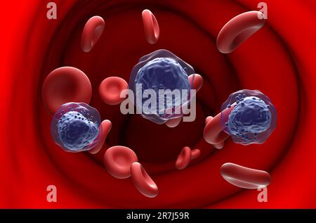 Cellule leucemiche mieloidi acute (LMA) nel flusso sanguigno - vista in sezione 3D illustrazione Foto Stock