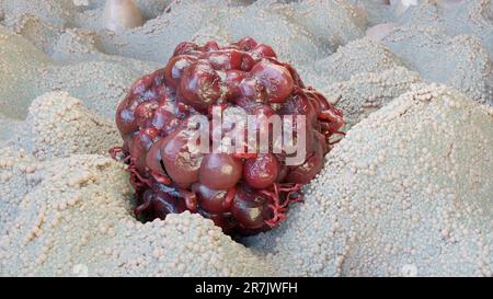 Crescita delle cellule tumorali incontrollabile sui tessuti, cellule di infezione tumorale e diffusione, metastasi infiammatoria invasiva cancerosa. riproduzione tramite duplicati Foto Stock