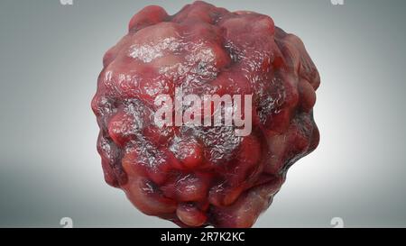 Crescita delle cellule tumorali incontrollabile sui tessuti, cellule di infezione tumorale e diffusione, metastasi infiammatoria invasiva cancerosa. riproduzione tramite duplicati Foto Stock