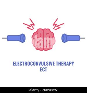 Terapia elettroconvulsiva ECT per il trattamento della depressione grave Illustrazione Vettoriale