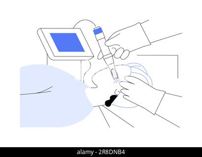 Illustrazione vettoriale del concetto astratto dell'applicazione laser medicale. Illustrazione Vettoriale