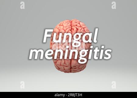 Sfondo di meningite fungina, sintomi di meningite, meningite batterica Foto Stock