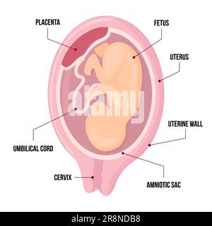 Infografica vettoriale con feto di utero e placenta. illustrazione del diagramma anatomico con cordone ombelicale e cervice. Vettore colorato Illustrazione Vettoriale
