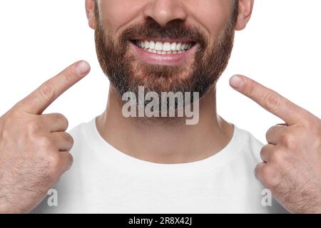 Uomo che mostra gengive sane su sfondo bianco, primo piano Foto Stock