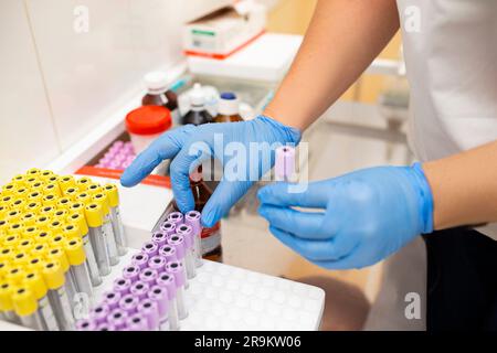 Molte scatole con provette da laboratorio in clinica. Un assistente di laboratorio lavora con le provette in un laboratorio di ricerca. Mano di un medico in un pro Foto Stock