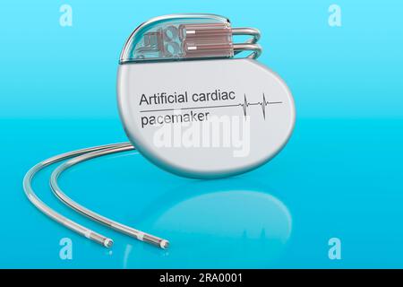 Pacemaker cardiaco artificiale su sfondo blu, rendering 3D. Foto Stock