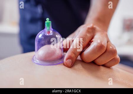 Extrime primo piano della mano maschile del massaggiatore che mette la lattina di guarigione sotto vuoto sul retro del suo cliente. Terapista maschile che sta curando con la coppettazione Foto Stock