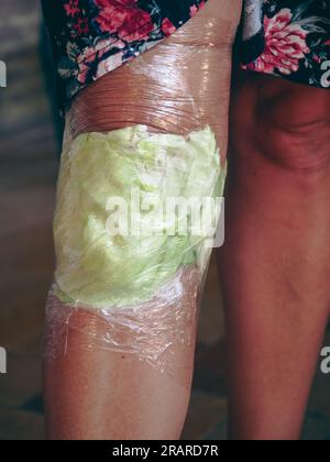 donna polso avvolto in foglie di cavolo compresso per effetto antinfiammatorio. Infiammazione della parte inferiore del corpo. Rimedi antichi italiani fatti in casa Foto Stock