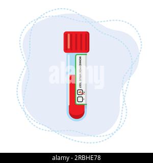 Provetta con sangue per la determinazione del virus del monkeypox. Illustrazione Vettoriale