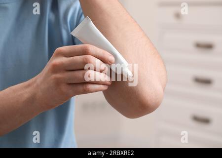 Uomo che applica unguento dal tubo al gomito al chiuso, primo piano Foto Stock