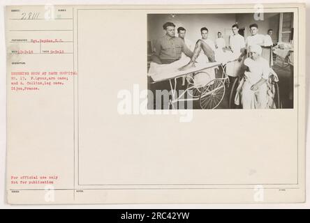 Soldati F. Lyons e A. Collins nello spogliatoio del base Hospital No. 17 a Digione, Francia. Lyons è in cura per un infortunio al braccio, mentre Collins è in cura per un infortunio alla gamba. Questa fotografia è destinata esclusivamente all'uso ufficiale e non alla pubblicazione. Scattata il 5 settembre 1918. Foto Stock