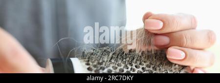 Le mani delle donne tengono il pettine con molti capelli. Problema di perdita dei capelli e concetto di salute dei capelli. Foto Stock