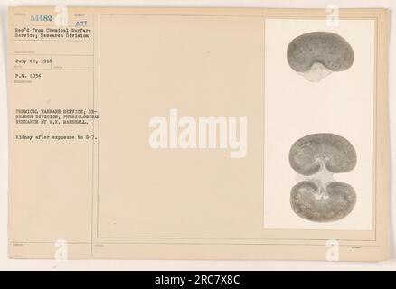 L'immagine raffigura un rene dopo l'esposizione al G-7, acquisito durante la ricerca fisiologica condotta da E.K. Marshall nel Chemical Warfare Service; Research Division. La fotografia è stata ricevuta il 12 luglio 1918, con il numero di descrizione 54482 e fa parte della collezione del Chemical Warfare Service. Foto Stock