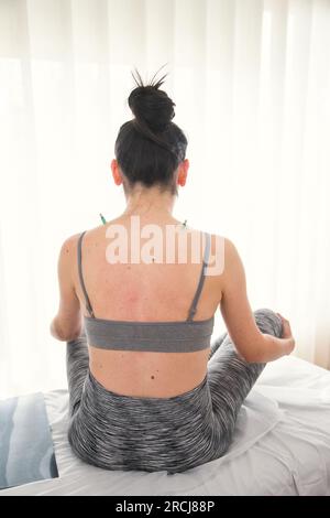 Donna che viene applicata una tecnica terapeutica della medicina tradizionale cinese usando il calore su alcune parti del corpo, moxibustion.trattamento di sollievo dal dolore Foto Stock