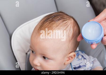 Applicare una crema e un olio speciali al cuoio capelluto del bambino per rimuovere gli sneiss o la crosta seborroica. Scale gialle sul cuoio capelluto. Foto Stock