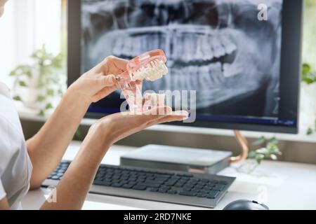 dentista implantologo che mostra il modello di denti con un campione di vite per impianto nello studio clinico Foto Stock