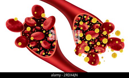 Diabete e diabete e glicemia come simbolo di ipoglicemia e iperglicemia o livelli normali di glucosio come simbolo di glicemia basso Foto Stock