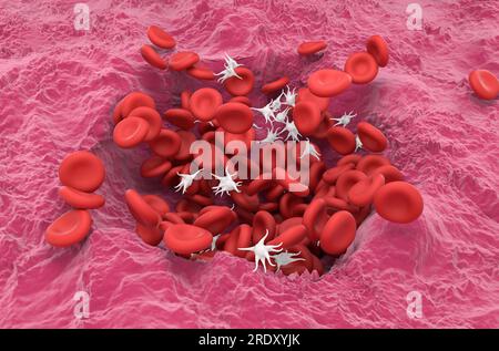 Eritrociti (RBC) e piastrine nella ferita di guarigione - visualizzazione isometrica illustrazione 3d. Foto Stock