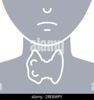 Ingrossamento della ghiandola tiroidea sul profilo del collo Illustrazione Vettoriale