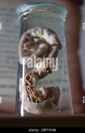 L'ascariasi è una malattia causata dal verme parassita Ascaris lumbricoides a formare in laboratorio. Foto Stock