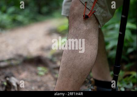 Immagine ravvicinata di un escursionista maschio è stato morso da una zanzara sulla gamba durante un'escursione nella forrest. Foto Stock