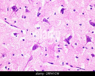 Istologia del tessuto cerebrale umano vista a ingrandimento 400x con ematossilina e colorazione di eosina. Foto Stock