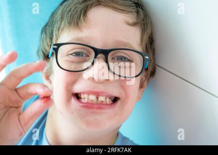 ritratto di un ragazzo con gli occhiali che mostra un osso di una ciliegia che ha mangiato. Un bambino allegro a casa in famiglia. Un'infanzia felice e spensierata. Foto Stock