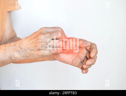 Donna anziana asiatica che graffia la mano. Concetto di malattie della pelle pruriginose come scabbia, infezione fungina, eczema, psoriasi, eruzione cutanea, allergia, ecc. Foto Stock