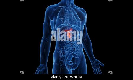 Cistifellea, illustrazione Foto Stock