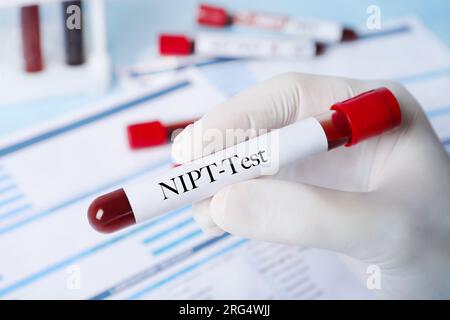 Test prenatali non invasivi (NIPT). Infermiere che tiene la provetta con il campione di sangue in laboratorio, primo piano Foto Stock