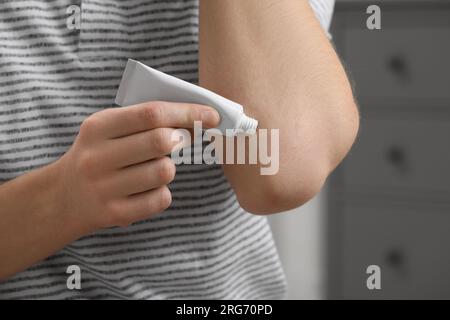 Uomo che applica unguento dal tubo al gomito all'interno, primo piano Foto Stock