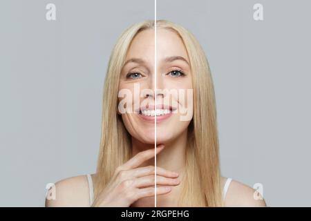 Bella faccia femminile prima e dopo la procedura di sollevamento cosmetici, ritratto da studio Foto Stock