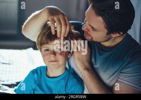 Il padre ispeziona suo figlio con dei graffi sulla faccia dopo la caduta Foto Stock