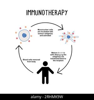 Immunoterapia: L'uso di farmaci o altre sostanze per stimolare il sistema immunitario del corpo a riconoscere e attaccare le cellule tumorali. Illustrazione Vettoriale