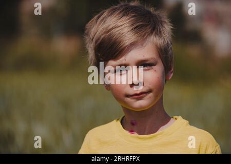 Ritratto all'aperto di un ragazzo con varicella Foto Stock