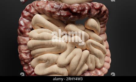 Cancro intestinale o tumore colorettale, cancro del colon, malattia infiammatoria intestinale, dolore intestinale, celiaco, infezioni, duplicazione, celle in espansione Foto Stock