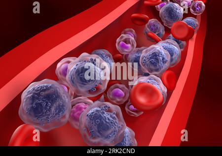 Cellule leucemiche mieloidi acute (AML) nel flusso sanguigno - primo piano - illustrazione 3D Foto Stock