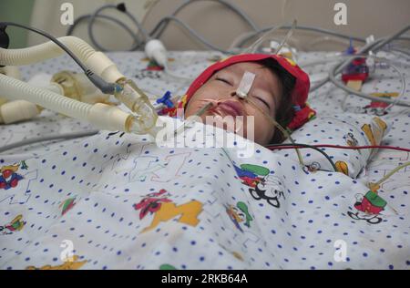 Bildnummer: 54485908 Datum: 28.09.2010 Copyright: imago/Xinhua (100929) -- PANAMA CITY, 29 settembre 2010 (Xinhua) -- Hannah Yanneth Fernandez è vista in un letto d'ospedale dopo che i medici hanno separato i gemelli congiunti a Panama City, Panama, 28 settembre 2010. Le gemelle di un anno collegate all'addome sono state separate chirurgicamente martedì da un team di 50 medici, segnando la prima operazione medica di Panama di questo tipo. (Xinhua) (gj) PANAMA-PANAMA CITY-CONJOINTED TWINS-SURGERY PUBLICATIONxNOTxINxCHN Gesellschaft siamesische Zwillinge Trennung Krankenhaus Klinik kbdig xsk 2010 quer premiumd xint o0 Foto Stock