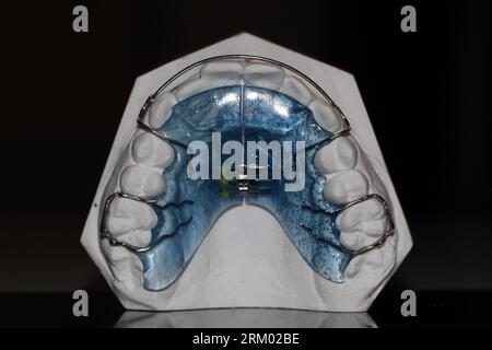 odontoiatrico modello ortosi resina cera dente Foto Stock