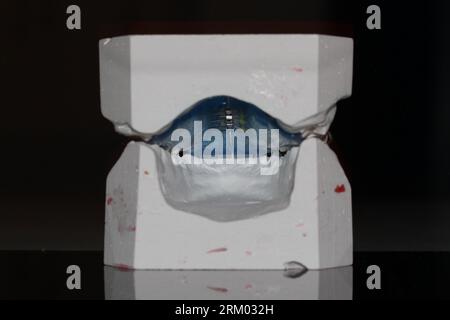 odontoiatrico modello ortosi resina cera dente Foto Stock