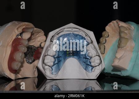 Modello odontoiatrico ortesi resina cera dentatura protesi rimovibile PAPM cobalto resina cromata cera dentatura telaio dentatura cera ceramico protesi fissa Foto Stock