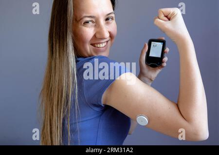 Ragazza che mostra il suo flash glucosio monitor con livello di zucchero nel sangue normale, toppa sulla mano Foto Stock